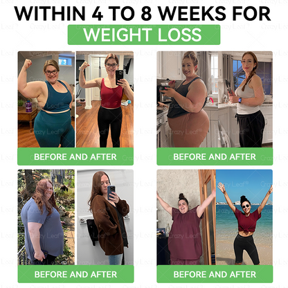 ✨ | 𝑶𝒇𝒇𝒊𝒄𝒊𝒂𝒍 𝑺𝒕𝒐𝒓𝒆 | 𝐂𝒓𝓪𝙯𝙮𝐋𝑒𝑎𝐟® 𝚂𝖬𝐺𝘛-𝘎𝐿𝙋-1 𝑆𝘭𝘪𝘮 & 𝘝𝘪𝘵𝘢𝘭𝘪𝘵𝘺 𝖮𝗋𝖺𝗅 𝐷rops 𝗍𝖺𝗋𝗀𝖾𝗍𝗌 𝑡𝑢𝑏𝑏𝑜𝑟𝑛 𝑤𝑒𝑖𝑔ℎ𝑡, ℎ𝑖𝑔ℎ 𝑏𝑙𝑜𝑜𝑑 𝑝𝑟𝑒𝑠𝑠𝑢𝑟𝑒, 𝑏𝑙𝑜𝑜𝑑 𝑠𝑢𝑔𝑎𝑟 ,𝘧𝘢𝘵𝘵𝘺 𝘭𝘪𝘷𝘦𝘳, 𝘫𝘰𝘪𝘯𝘵 𝘱𝘢𝘪𝘯, 𝘧𝘢𝘵𝘪𝘨𝘶𝘦,𝑙𝑜𝑤 𝑒𝑛𝑒𝑟𝑔𝑦, 𝑠𝑎𝑔𝑔𝑖𝑛𝑔 𝑠𝑘𝑖𝑛 & 𝑚𝑜𝑟𝑒 𝑓𝑜𝑟 𝑏𝑒𝑡𝑡𝑒𝑟 ℎ𝑒𝑎𝑙𝑡ℎ & 𝑣𝑖𝑡𝑎𝑙𝑖𝑡𝑦