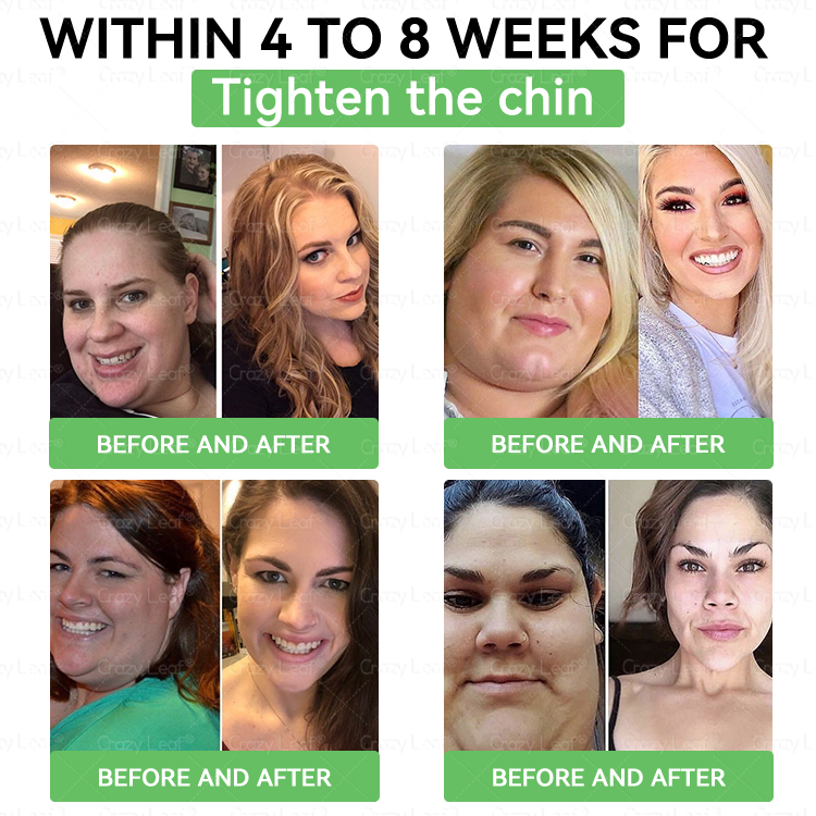 ✨ | 𝑶𝒇𝒇𝒊𝒄𝒊𝒂𝒍 𝑺𝒕𝒐𝒓𝒆 | 𝐂𝒓𝓪𝙯𝙮𝐋𝑒𝑎𝐟® 𝚂𝖬𝐺𝘛-𝘎𝐿𝙋-1 𝑆𝘭𝘪𝘮 & 𝘝𝘪𝘵𝘢𝘭𝘪𝘵𝘺 𝖮𝗋𝖺𝗅 𝐷rops 𝗍𝖺𝗋𝗀𝖾𝗍𝗌 𝑡𝑢𝑏𝑏𝑜𝑟𝑛 𝑤𝑒𝑖𝑔ℎ𝑡, ℎ𝑖𝑔ℎ 𝑏𝑙𝑜𝑜𝑑 𝑝𝑟𝑒𝑠𝑠𝑢𝑟𝑒, 𝑏𝑙𝑜𝑜𝑑 𝑠𝑢𝑔𝑎𝑟 ,𝘧𝘢𝘵𝘵𝘺 𝘭𝘪𝘷𝘦𝘳, 𝘫𝘰𝘪𝘯𝘵 𝘱𝘢𝘪𝘯, 𝘧𝘢𝘵𝘪𝘨𝘶𝘦,𝑙𝑜𝑤 𝑒𝑛𝑒𝑟𝑔𝑦, 𝑠𝑎𝑔𝑔𝑖𝑛𝑔 𝑠𝑘𝑖𝑛 & 𝑚𝑜𝑟𝑒 𝑓𝑜𝑟 𝑏𝑒𝑡𝑡𝑒𝑟 ℎ𝑒𝑎𝑙𝑡ℎ & 𝑣𝑖𝑡𝑎𝑙𝑖𝑡𝑦